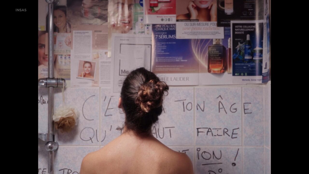 Lion’s wrinkle and Crow’s feet